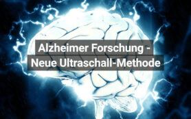 Methode Gegen Alzheimer